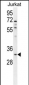OR5B12 Antibody (C-term)